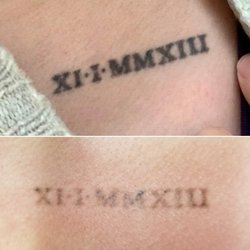 Nu Skyn - Nice fade for a beautiful cover up. Done in 6 sessions.