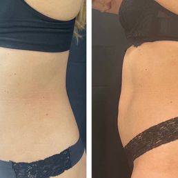 Left: before with a squishier and less toned stomach, Right: more defined stomach and less pooch