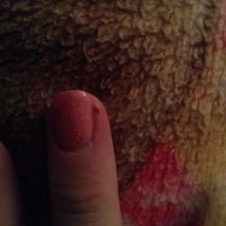 M K Nails Salon & Skin Care - This was the bad gash.
