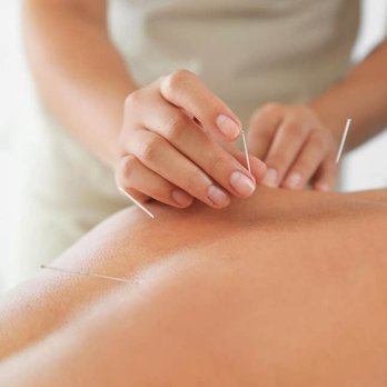 Acutherapy Clinics - Acupuncture Near Me - Honolulu, Hawaii Acutherapy Clinics - Acupuncture Near Me - Honolulu, Hawaii