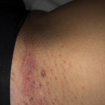 Ted D Bare - On the other side - Waxing Near Me - San Jose, California