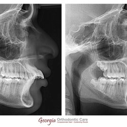 Georgia Orthodontic Care