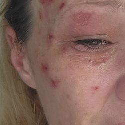 Tennessee River Dermatology - On way home from your place CRYING? I promise one day she will see a video of you crying it's been a year that's a promise