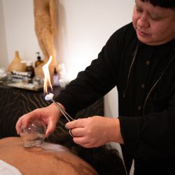 For the Love Acupuncture & Wellness - Image description: Paolo  in a black shirt using a bulbous glass cup and a flaming swab to administer cupping on a patient's bare back.