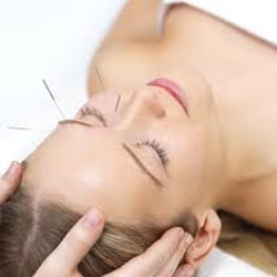 Tranquil Body - Relieve pain and relax your mind with acupuncture.