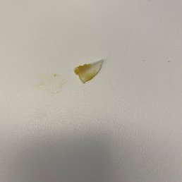 A piece of plastic in my pineapple bun... good thing it wasn't glass