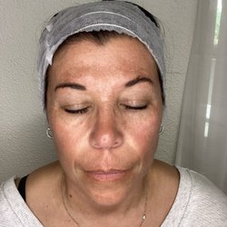 Smooth Skin Centers