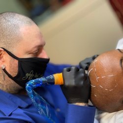 Nico's SMP and Hair Studio - Scalp Micropigmentation (SMP) procedure