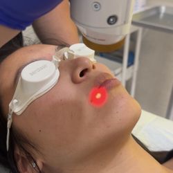 Lumina Med Spa - Aerolase