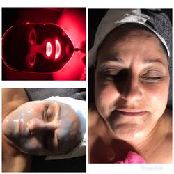 Ang Esthetics - Microdermabrasion followed with LED red light therapy, hydrating mask