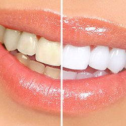 White Smile Center