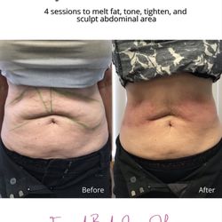 Face & Body Laser Hawaii