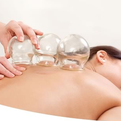 Denise Patnod Acupuncture Clinic - Cupping: excellent for releasing tension. Great for colds, releases the congestion.