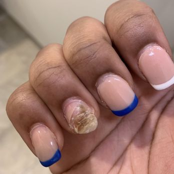 Nail Bar - My nail broke after a week and now I have an infection under my nails - Nail Salons Near Me - Bolingbrook, Illinois Nail Bar - My nail broke after a week and now I have an infection under my nails - Nail Salons Near Me - Bolingbrook, Illinois