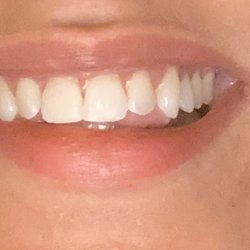 Ronald A Maple, DDS - Corneliuis Pass Dental Excellence - After