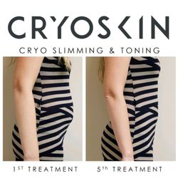 EK Beaute Salon & Med-Spa - Slimming and toning 1st sesion