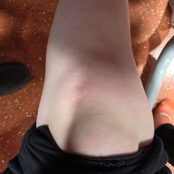 Sky Zone Trampoline Park - My knee