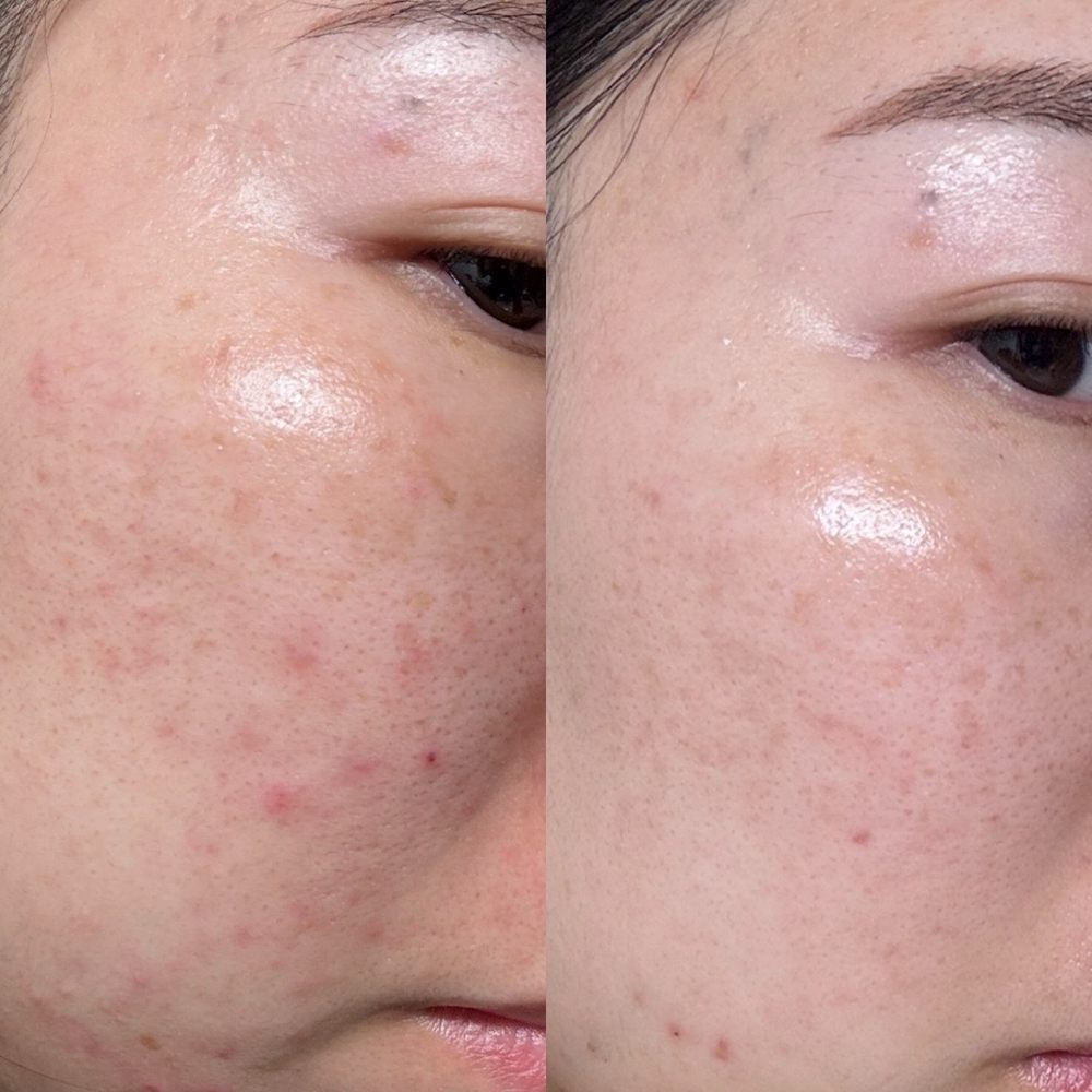 Avanti Laser Clinic - Skin Care Near Me - Fullerton, California Avanti Laser Clinic - Skin Care Near Me - Fullerton, California
