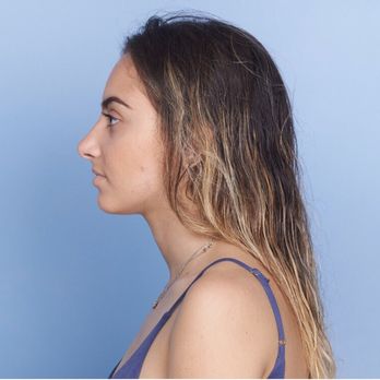 Burbank Plastic Surgery - I am amazed - Cosmetic Surgeons Near Me - Burbank, California Burbank Plastic Surgery - I am amazed - Cosmetic Surgeons Near Me - Burbank, California