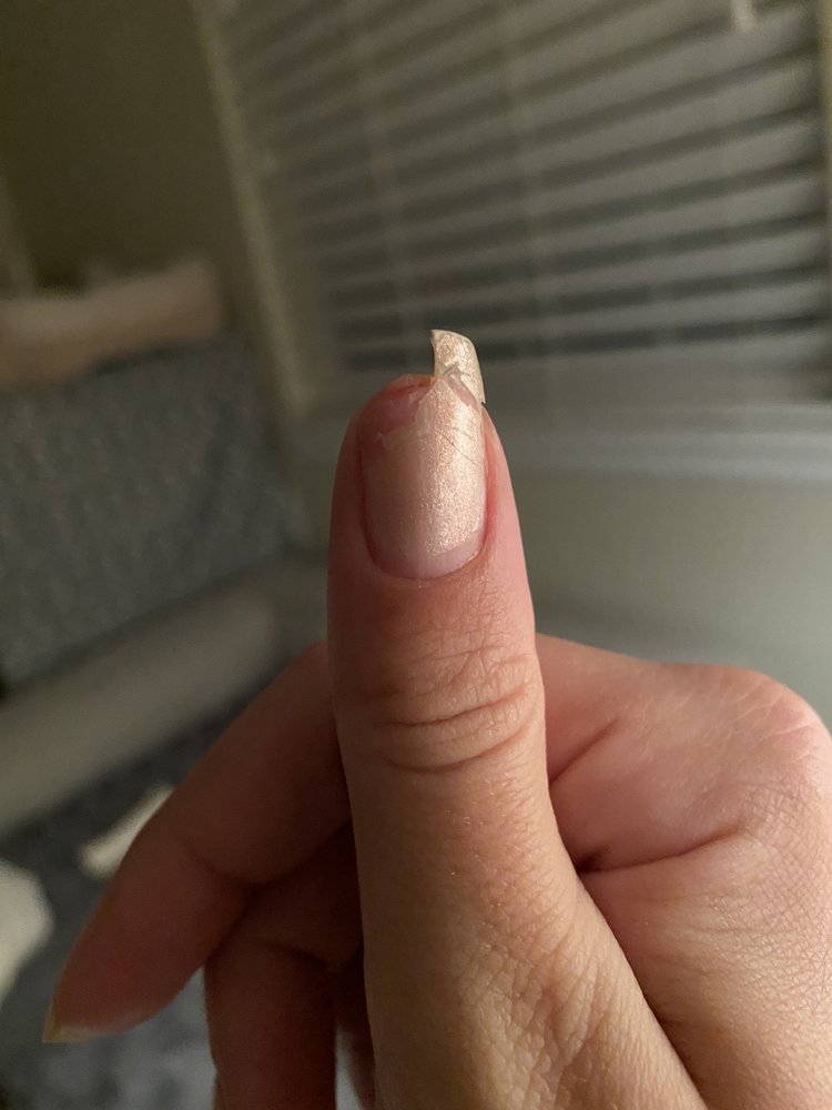 TIP TO TOE NAILS DTC 176 Photos & 198 Reviews 8775 E Orchard Rd