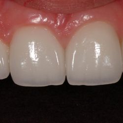 Pacific Dental Care
