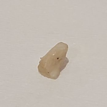 Ramen-Ya - The cooks tooth we found in the ramen. Yuck!!!!!!!!!!!! - Ramen Near Me - Kapolei, Hawaii Ramen-Ya - The cooks tooth we found in the ramen. Yuck!!!!!!!!!!!! - Ramen Near Me - Kapolei, Hawaii