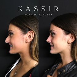 Ramtin Kassir, MD - Kassir Plastic Surgery