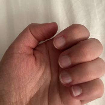 LK Nails - A photograph of a person's hand showing the palm side with five fingers, fingernails, and skin details, against a light background. - Nail Salons Near Me - Arvada, Colorado