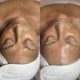 Photo of Remedy Corrective Skin