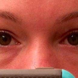 If you notice on my left brow, the length is fairly shorter than the right side. If you notice on my left brow, the length is fairly shorter than the right side.