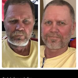 Shears and Beards