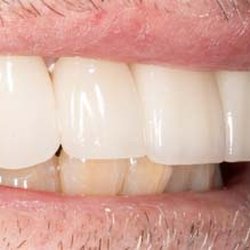 Sturgeon Dental Malibu
