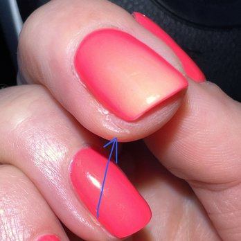 Pandora Nail Spa - Cut from filing blade. - Nail Salons Near Me - Lafayette, California Pandora Nail Spa - Cut from filing blade. - Nail Salons Near Me - Lafayette, California