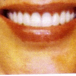 Dental Prosthetix