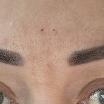 Miami Brow Bar - My previous powdered eyebrows before getting laser. - Permanent Makeup Near Me - Coral Gables, Florida Miami Brow Bar - My previous powdered eyebrows before getting laser. - Permanent Makeup Near Me - Coral Gables, Florida
