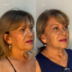 Blue Medi Spa