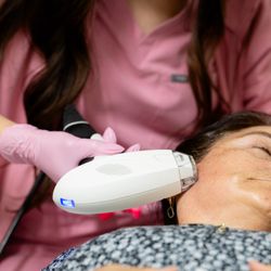 The Empress LA - RF microneedling