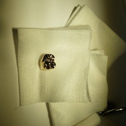 My new gold crown finally in!