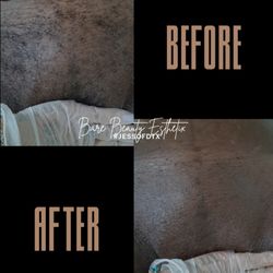 Bare Beauty× - Brazilian wax
