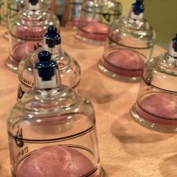 Cupping therapy