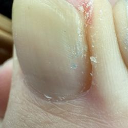 First Hollywood Nails - My nail where she kept cutting (my nails were long) Yes I was overdue for a pedicure which is why I was trying to get this done