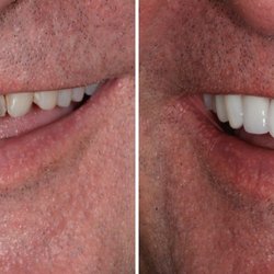 AH Smiles: Brent A. Engelberg