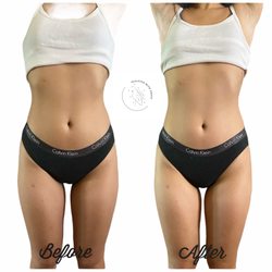 Sculpted with Grace - REDUCES BLOATING AND INCH LOSS.
HEAT THERAPY AND CAVI LIPO COMBO.
PAINLESS AND NON INVASIVE METHOD OF BODY SCULPTING