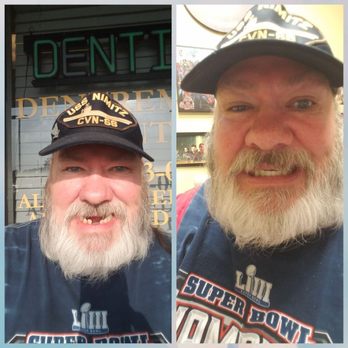 Dentremont Dental Services - Before & after :-) - General Dentistry Near Me - Gulf Shores, Alabama Dentremont Dental Services - Before & after :-) - General Dentistry Near Me - Gulf Shores, Alabama