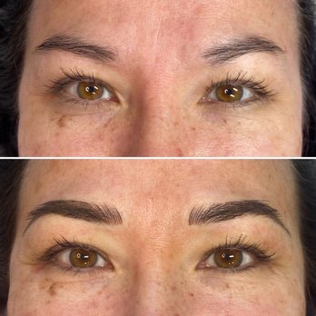 Skin By Beth Ann Warren - Before and After - Skin Care Near Me - Lake Oswego, Oregon Skin By Beth Ann Warren - Before and After - Skin Care Near Me - Lake Oswego, Oregon