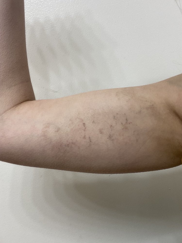 LASER GODDESS 20 Photos & 33 Reviews 20935 Northern Blvd, Bayside