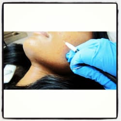 Perfection Electrolysis