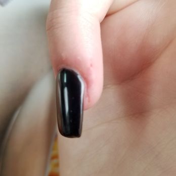 Bella Nails Spa - Cut my finger the technician was in such a hurry - Nail Salons Near Me - Napa, California Bella Nails Spa - Cut my finger the technician was in such a hurry - Nail Salons Near Me - Napa, California
