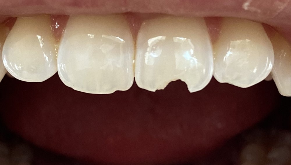 GRAMERCY DENTAL CENTER Updated May 2024 27 Photos & 32 Reviews 118 E 19th St, New York