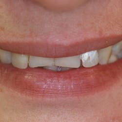 MiamiDentist4U by Javier Andrade DDS - Before